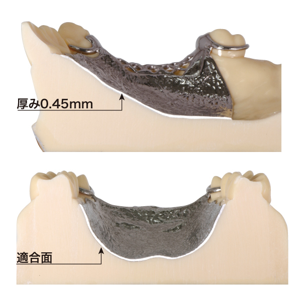 須山歯研のチタン鋳造