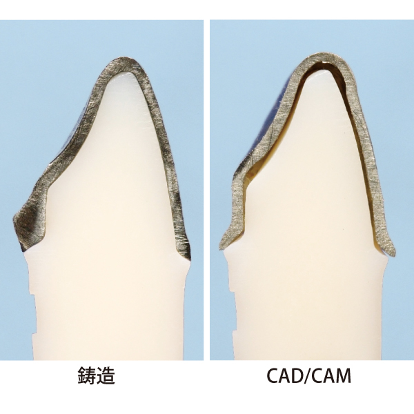 須山歯研のチタン鋳造